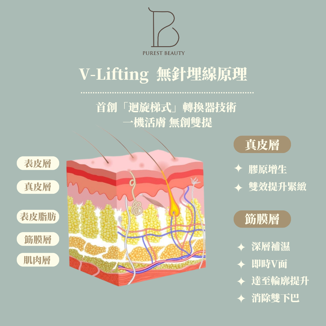 V Lift Hifu 無針埋線 (眼、面、頸)
