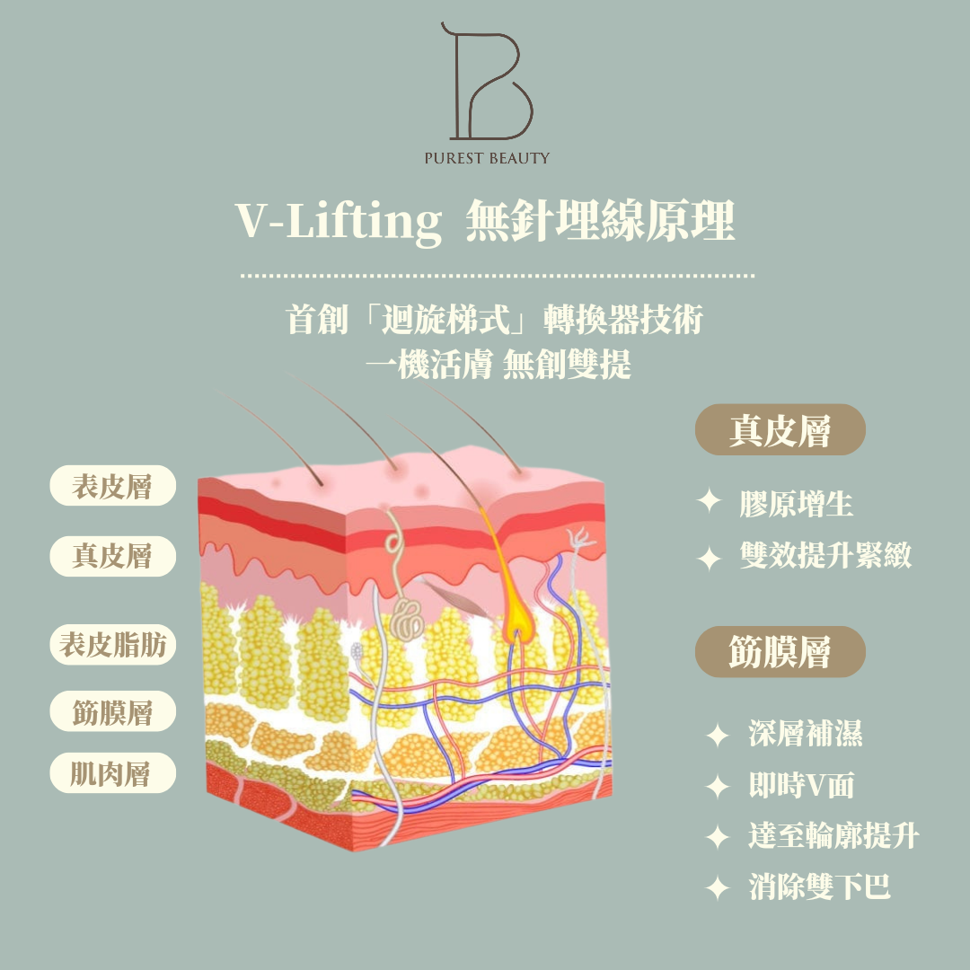 V Lift Hifu 無針埋線 (眼、面、頸）