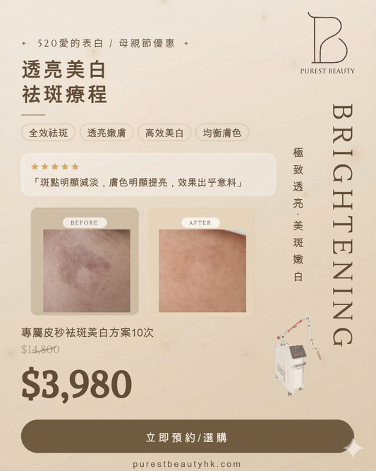 別讓斑點洩漏年齡！$3,980 /10次體驗皮秒淨白奇蹟 ⚡️